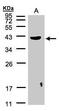 Pleckstrin antibody, PA5-21753, Invitrogen Antibodies, Western Blot image 