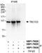 TBC1 Domain Family Member 2 antibody, NBP1-79030, Novus Biologicals, Western Blot image 