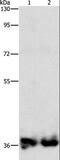 Aspartoacylase antibody, LS-C401413, Lifespan Biosciences, Western Blot image 