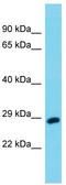 Ubiquitin C-Terminal Hydrolase L3 antibody, TA342564, Origene, Western Blot image 