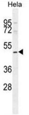 SET And MYND Domain Containing 1 antibody, AP53954PU-N, Origene, Western Blot image 