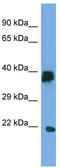 Lipoyl(Octanoyl) Transferase 2 antibody, TA331034, Origene, Western Blot image 
