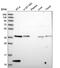 Coagulation Factor VIII Associated 3 antibody, PA5-61382, Invitrogen Antibodies, Western Blot image 