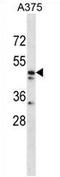 ZPR1 Zinc Finger antibody, AP54681PU-N, Origene, Western Blot image 