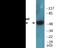 Protein Tyrosine Kinase 6 antibody, EKC2193, Boster Biological Technology, Western Blot image 