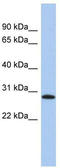 LysM Domain Containing 1 antibody, TA335114, Origene, Western Blot image 