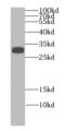 Inhibitor Of Growth Family Member 4 antibody, FNab04314, FineTest, Western Blot image 