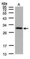 CTD Small Phosphatase 2 antibody, TA308633, Origene, Western Blot image 