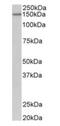 Protocadherin 17 antibody, NBP1-97757, Novus Biologicals, Western Blot image 