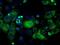 Hydroxysteroid 17-Beta Dehydrogenase 10 antibody, GTX84344, GeneTex, Immunofluorescence image 