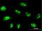 Nucleolar protein 14 antibody, H00008602-B01P, Novus Biologicals, Immunofluorescence image 