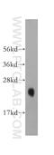 Potassium Voltage-Gated Channel Interacting Protein 1 antibody, 14212-1-AP, Proteintech Group, Western Blot image 
