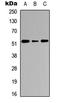 Cathepsin C antibody, LS-C354305, Lifespan Biosciences, Western Blot image 