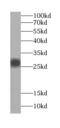 HAUS Augmin Like Complex Subunit 4 antibody, FNab01027, FineTest, Western Blot image 