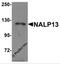 NLR Family Pyrin Domain Containing 13 antibody, 5973, ProSci, Western Blot image 
