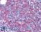 Lymphocyte Cytosolic Protein 1 antibody, LS-B2608, Lifespan Biosciences, Immunohistochemistry paraffin image 