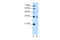 Sodium-coupled neutral amino acid transporter 3 antibody, ARP42323_P050, Aviva Systems Biology, Western Blot image 