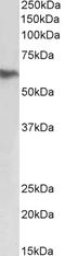 Fibrinogen Beta Chain antibody, LS-C305842, Lifespan Biosciences, Western Blot image 