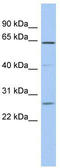Family With Sequence Similarity 71 Member B antibody, TA340265, Origene, Western Blot image 