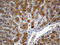 Mitochondrial Fission Regulator 2 antibody, M14757-1, Boster Biological Technology, Immunohistochemistry paraffin image 