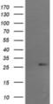 RCAN Family Member 3 antibody, NBP2-45928, Novus Biologicals, Western Blot image 