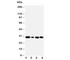 CA1 antibody, R30495, NSJ Bioreagents, Western Blot image 