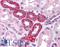 Ribosomal Protein S6 Kinase B1 antibody, LS-B4439, Lifespan Biosciences, Immunohistochemistry frozen image 
