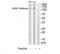 BUB1 Mitotic Checkpoint Serine/Threonine Kinase antibody, TA312146, Origene, Western Blot image 