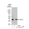 GAPDH antibody, GTX100118, GeneTex, Immunoprecipitation image 