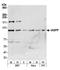 RelA-associated inhibitor antibody, A301-737A, Bethyl Labs, Western Blot image 
