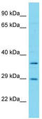Fumarylacetoacetate Hydrolase Domain Containing 1 antibody, TA332254, Origene, Western Blot image 
