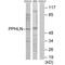 Periphilin 1 antibody, A06996, Boster Biological Technology, Western Blot image 