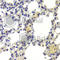 Histone Deacetylase 5 antibody, A7189, ABclonal Technology, Immunohistochemistry paraffin image 