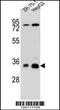 Methylenetetrahydrofolate Dehydrogenase (NADP+ Dependent) 2 Like antibody, 55-772, ProSci, Western Blot image 