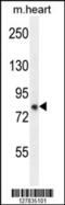 Zinc Finger FYVE-Type Containing 28 antibody, 55-268, ProSci, Western Blot image 