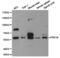 Calcium/calmodulin-dependent 3 ,5 -cyclic nucleotide phosphodiesterase 1B antibody, LS-C192857, Lifespan Biosciences, Western Blot image 