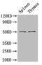 Tubulin Beta 3 Class III antibody, A51998-100, Epigentek, Western Blot image 