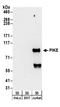 Arf-GAP with GTPase, ANK repeat and PH domain-containing protein 2 antibody, A304-262A, Bethyl Labs, Western Blot image 