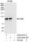 XPA Binding Protein 2 antibody, A303-637A, Bethyl Labs, Immunoprecipitation image 