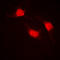 Catenin Beta 1 antibody, LS-C352117, Lifespan Biosciences, Immunofluorescence image 