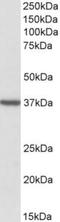 Translocase Of Outer Mitochondrial Membrane 40 antibody, TA311349, Origene, Western Blot image 