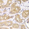 Ribosomal Protein S4 X-Linked antibody, LS-C334907, Lifespan Biosciences, Immunohistochemistry paraffin image 