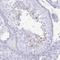 Sperm Associated Antigen 4 antibody, HPA061789, Atlas Antibodies, Immunohistochemistry paraffin image 