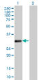Voltage-dependent anion-selective channel protein 2 antibody, LS-C198424, Lifespan Biosciences, Western Blot image 