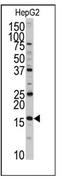 DCTP Pyrophosphatase 1 antibody, AP12472PU-N, Origene, Western Blot image 