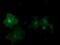 cGMP-dependent 3 ,5 -cyclic phosphodiesterase antibody, NBP2-03598, Novus Biologicals, Immunofluorescence image 