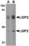 Probable ATP-dependent RNA helicase DHX58 antibody, TA306482, Origene, Western Blot image 
