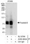 Frizzled Class Receptor 6 antibody, A302-963A, Bethyl Labs, Immunoprecipitation image 