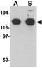 Zinc Finger MYM-Type Containing 2 antibody, GTX31821, GeneTex, Western Blot image 