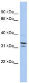 Family With Sequence Similarity 92 Member B antibody, TA333366, Origene, Western Blot image 